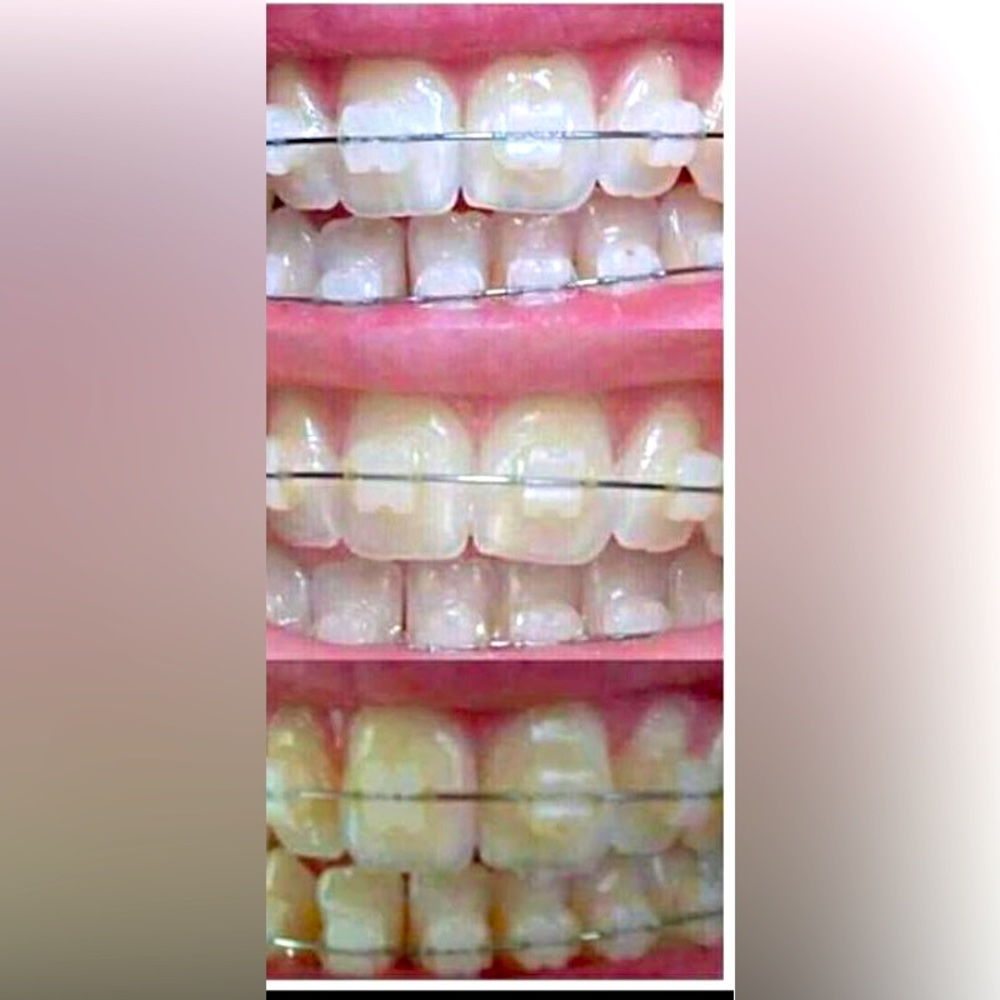 New toothpaste